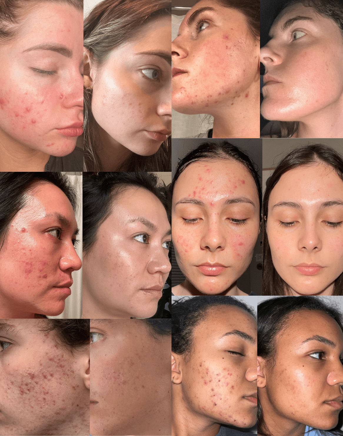 Masque à l'huile de chanvre anti-imperfections